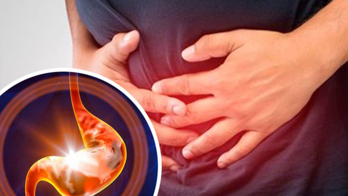 Gastritis – ishrana i suplementacija